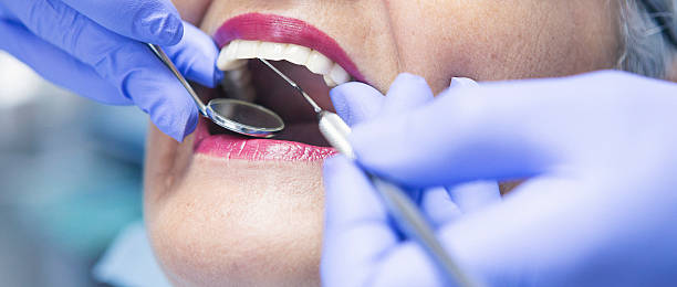Best Urgent Tooth Repair  in Su Oswego, NY